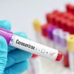 Coronavirus-Test-Lab-Test-Tube