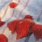 blood-stains,jpg